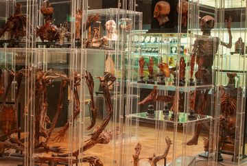 Anatomisches Museum Innsbruck