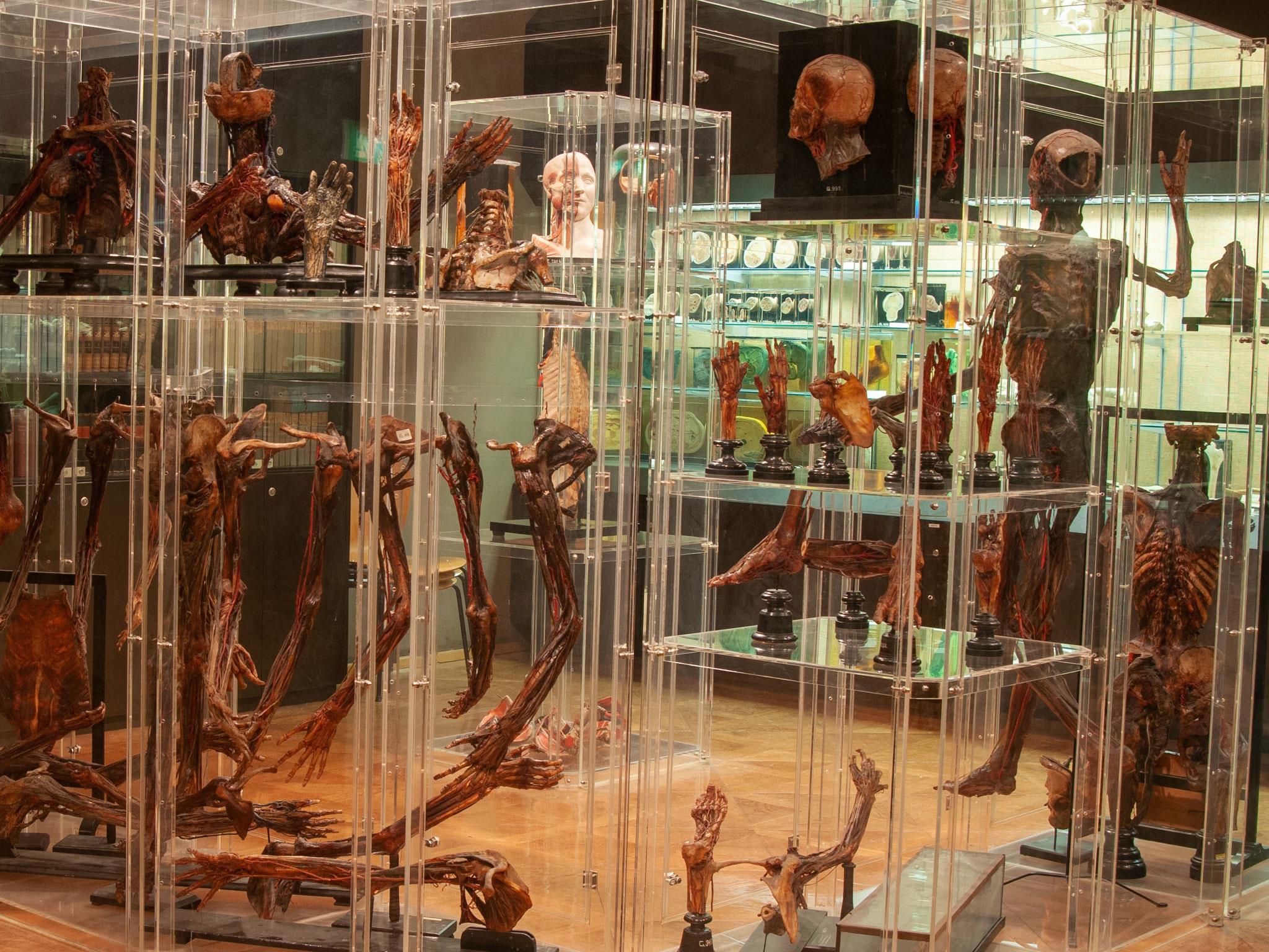 Anatomisches Museum Innsbruck